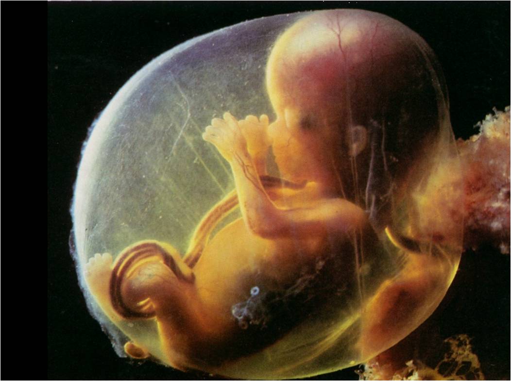 Are Those Who Die in the Womb Saved?